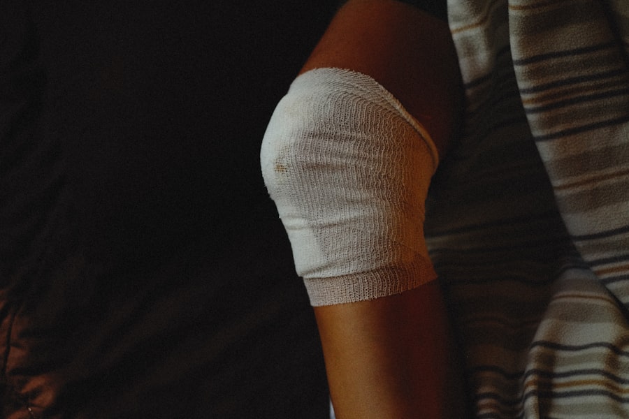 shin splints