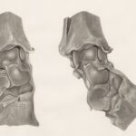 Photo shin splints