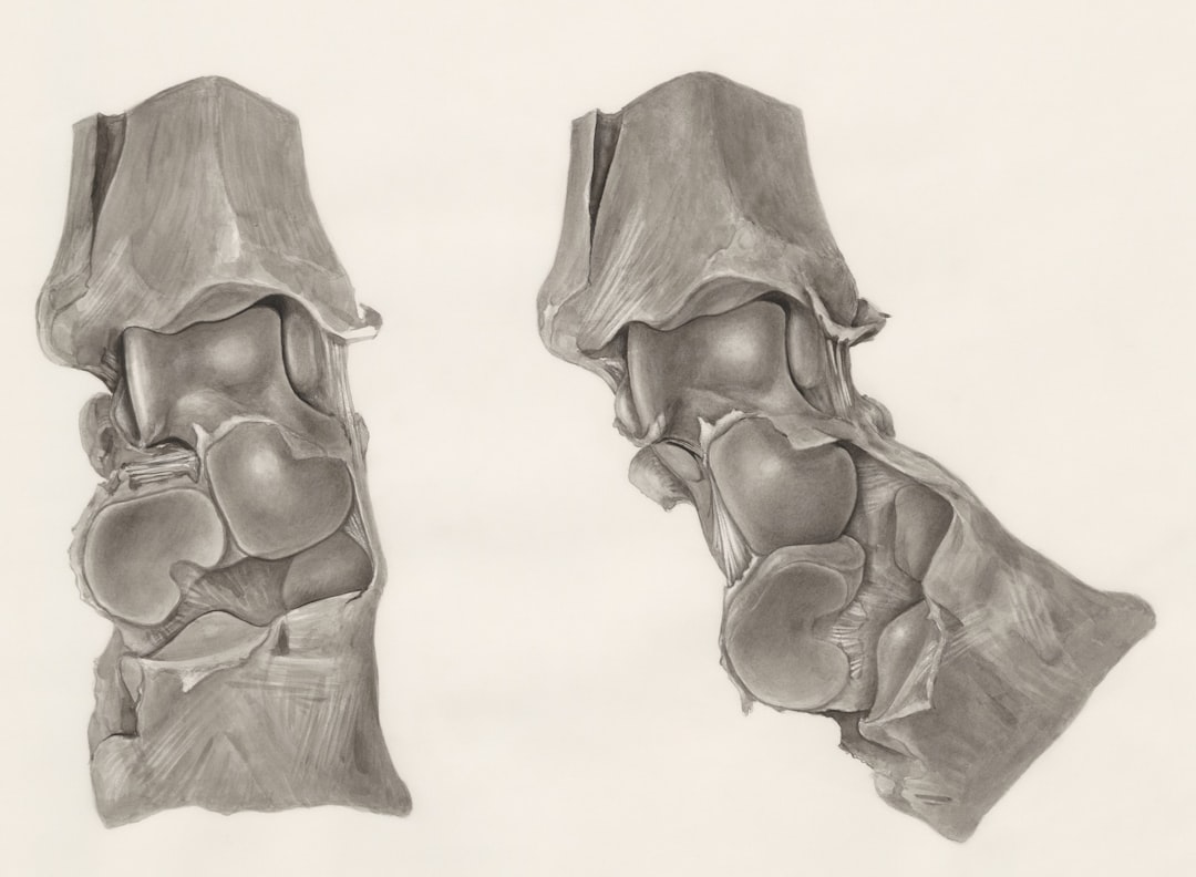 Photo shin splints