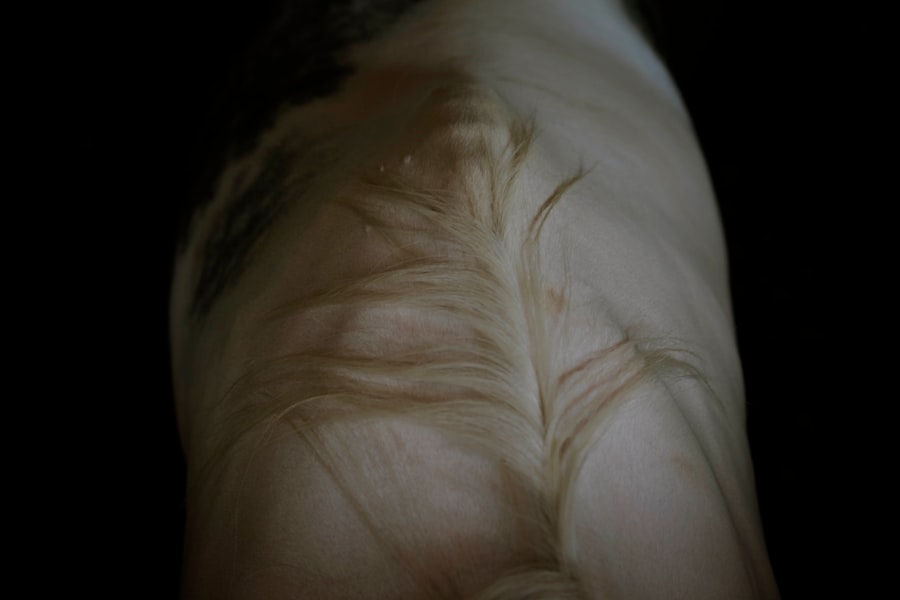 Photo shin splints